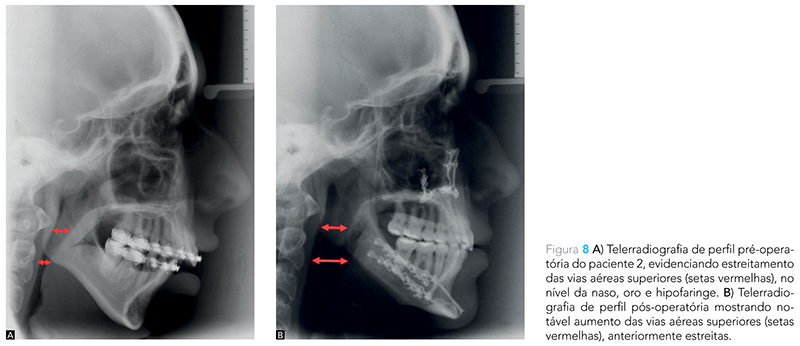 Expert_v12_n02_fig08