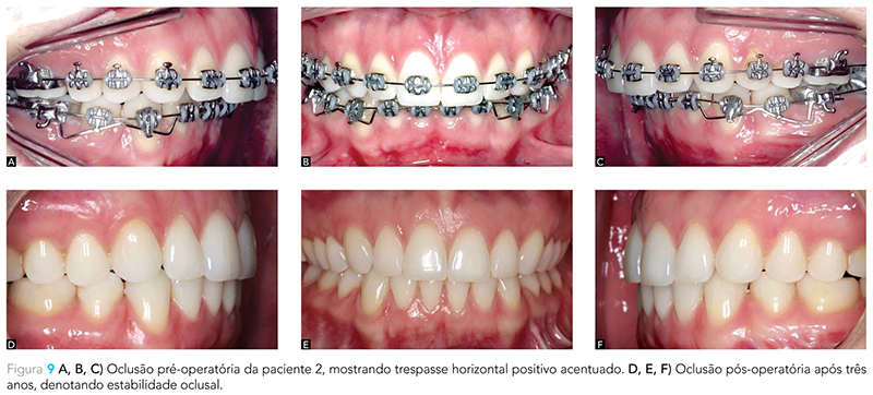 Expert_v12_n02_fig09