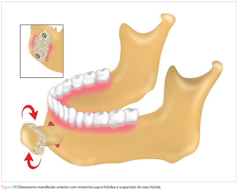 Expert_v12_n02_fig10