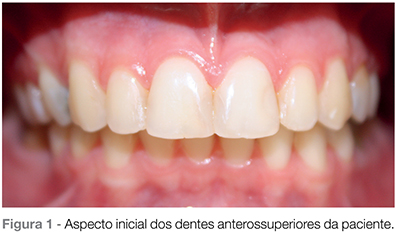 Clareamento dentário