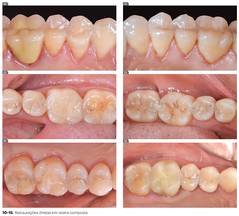 est_v10_n03_107fig10_15
