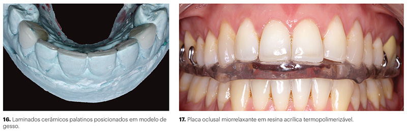 est_v10_n03_107fig16_17
