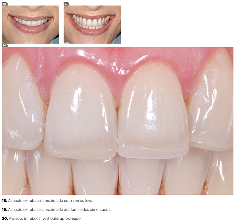 est_v10_n03_107fig18_20