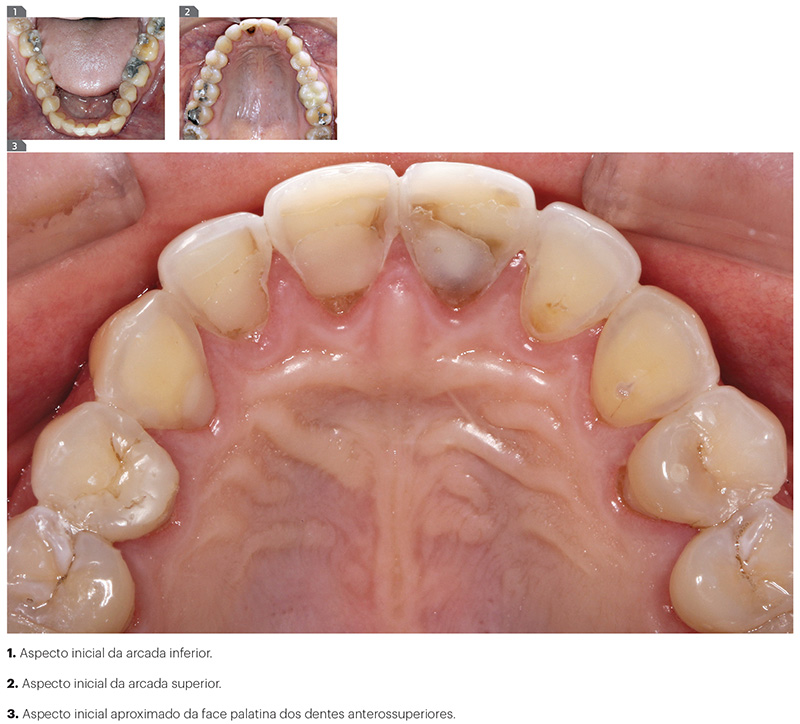 est_v10_n03_107fig1_3