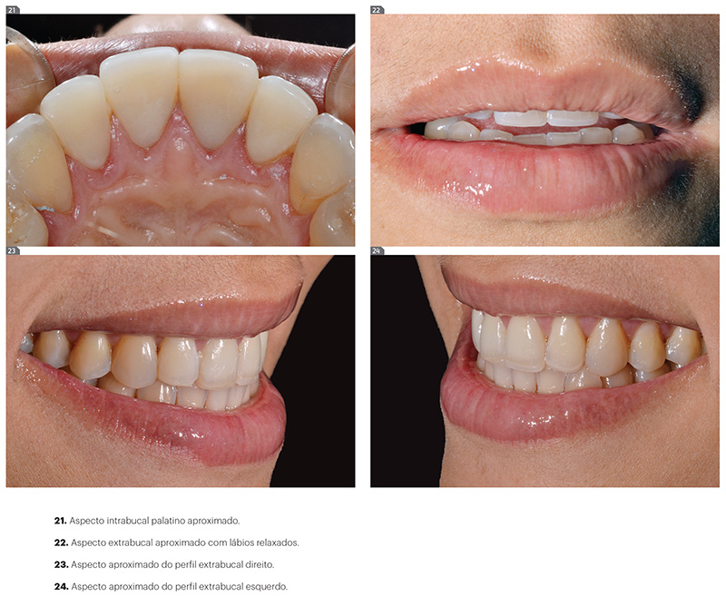 est_v10_n03_107fig20_24