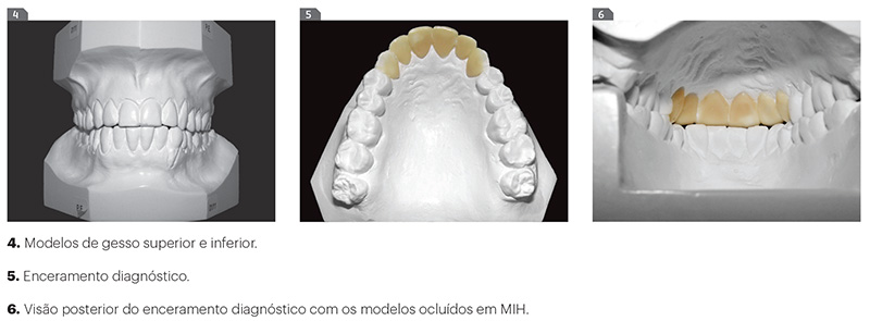 est_v10_n03_107fig4_6