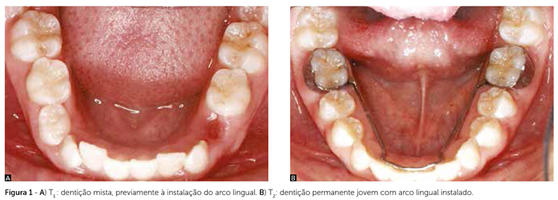 v_18_n_03_29fig01