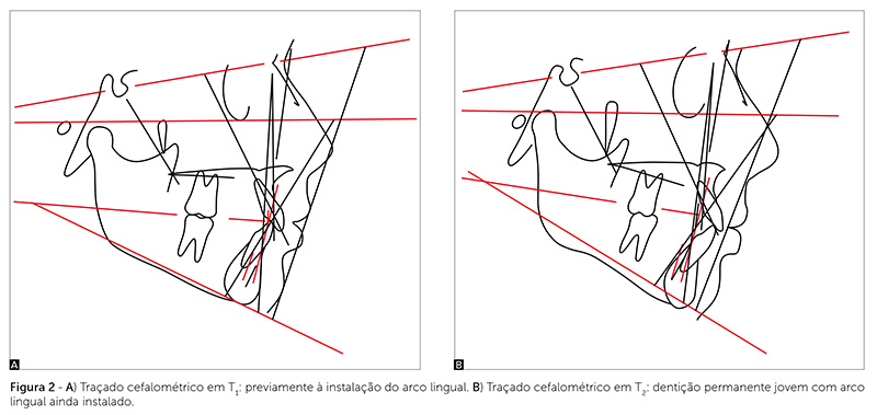 v_18_n_03_29fig02