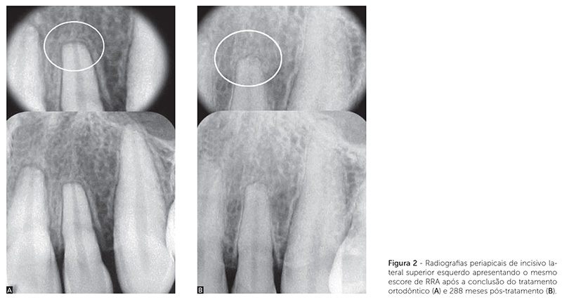 v_18_n_04_104fig2