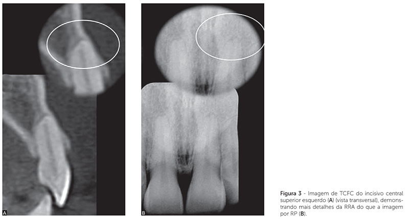 v_18_n_04_104fig3