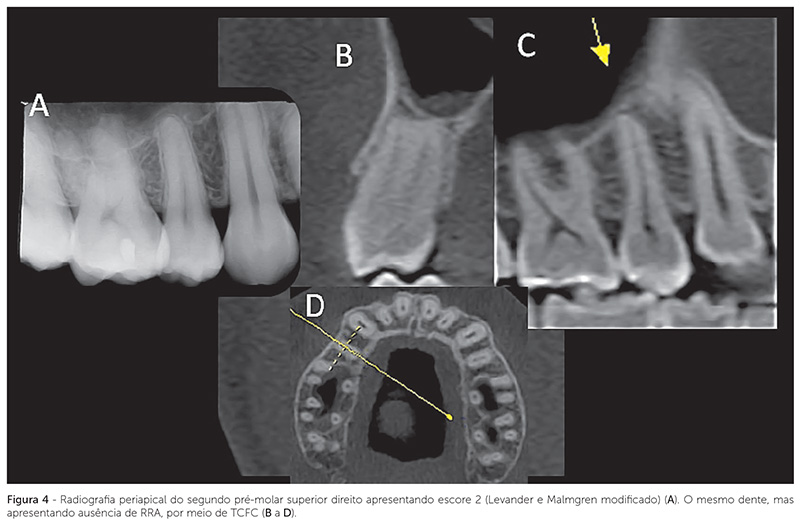v_18_n_04_104fig4