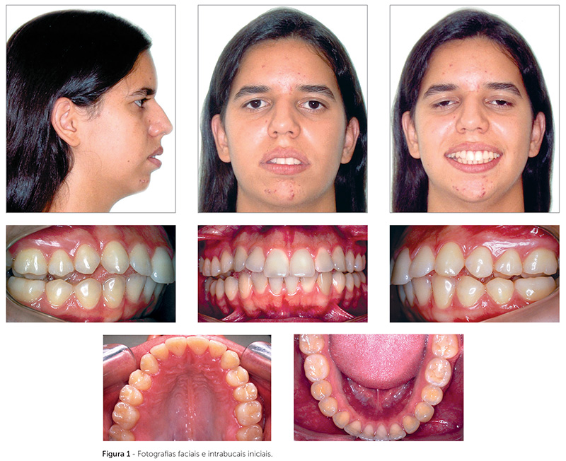 v_18_n_05_140fig1