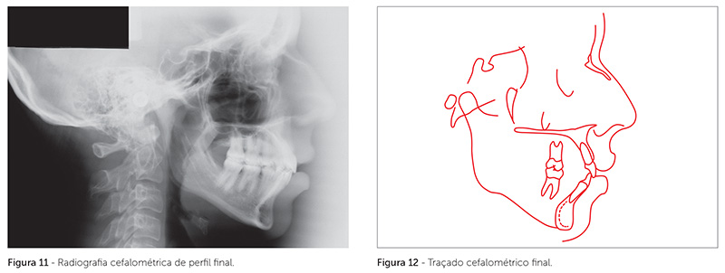 v_18_n_05_140fig11_12