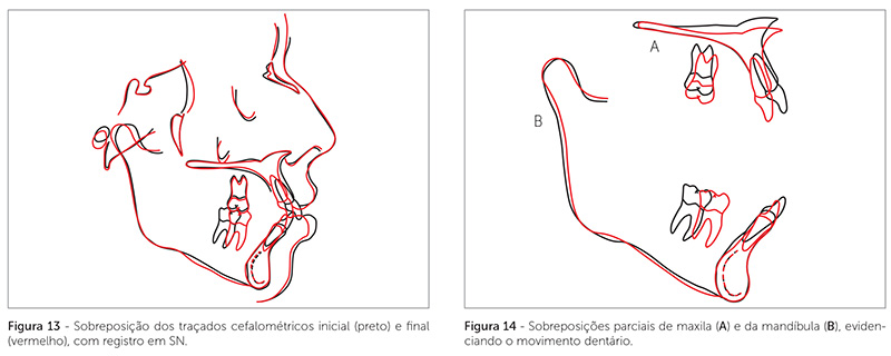 v_18_n_05_140fig13_14