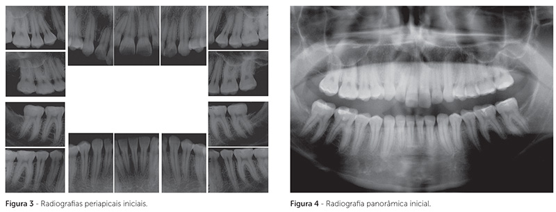 v_18_n_05_140fig3_4