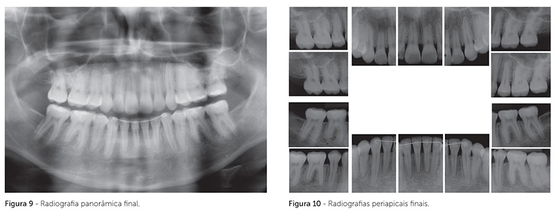 v_18_n_05_140fig9_10