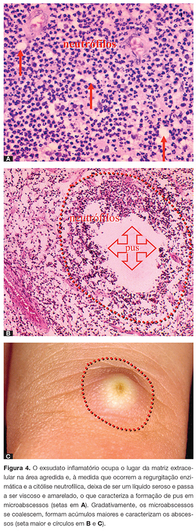 endo_v03_n03_10fig04