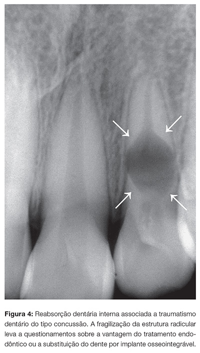 clinica_v12_n06_102fig04