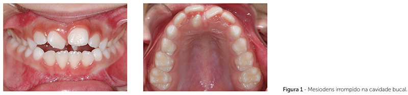 dpjo_v18_n06_93fig01