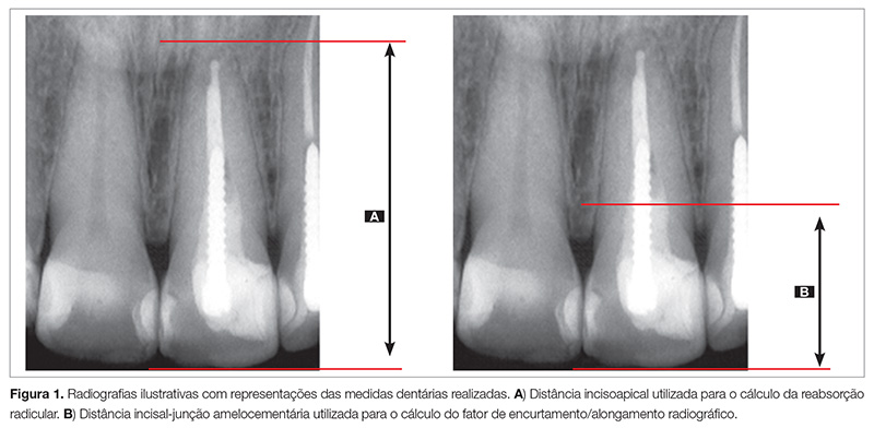 endo_v03_n03_69fig01