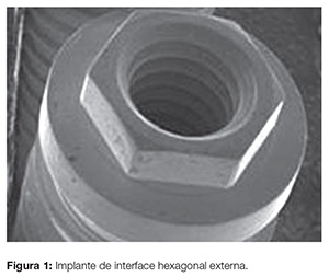 implant_v07_n04_90fig01