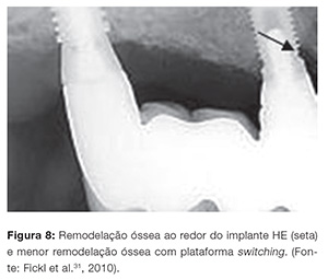 implant_v07_n04_90fig08