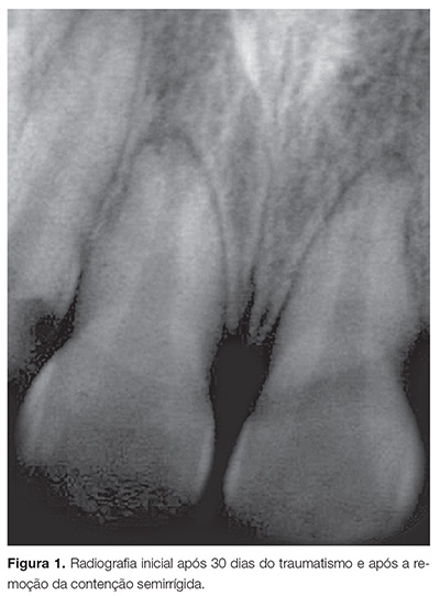 endo_v04_n01_76fig01