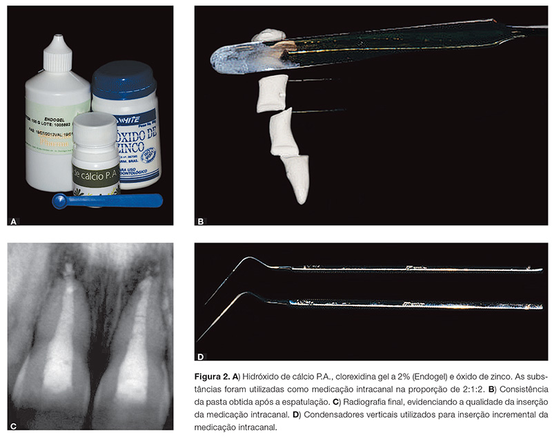 endo_v04_n01_76fig02