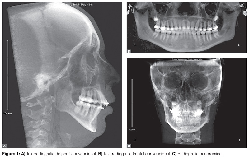 vantagens da tomografia