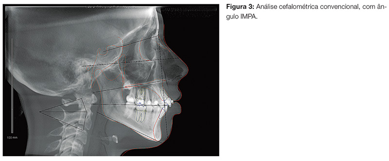 vantagens da tomografia