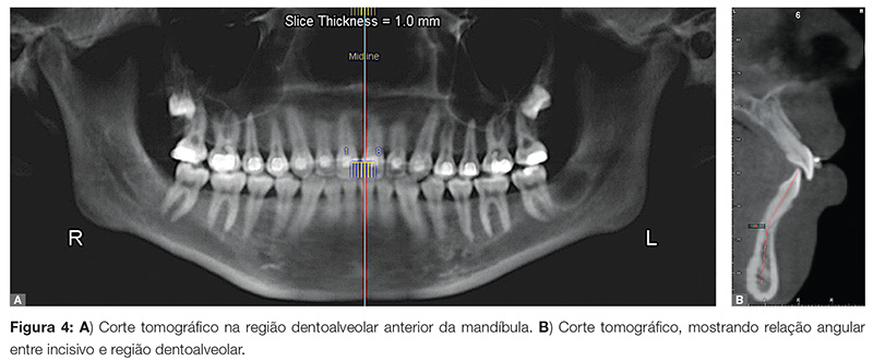 vantagens da tomografia