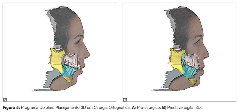 vantagens da tomografia