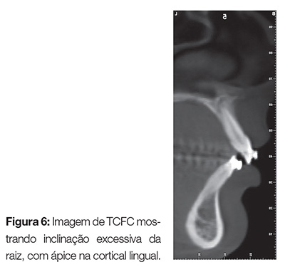 vantagens da tomografia