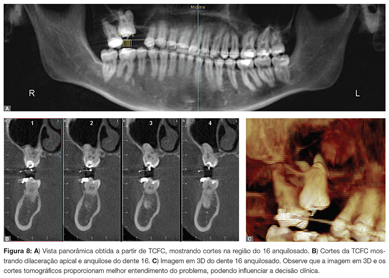 vantagens da tomografia