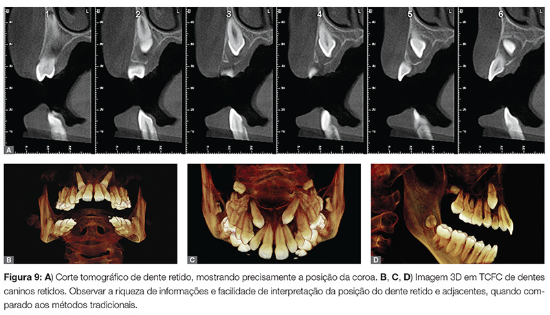 vantagens da tomografia