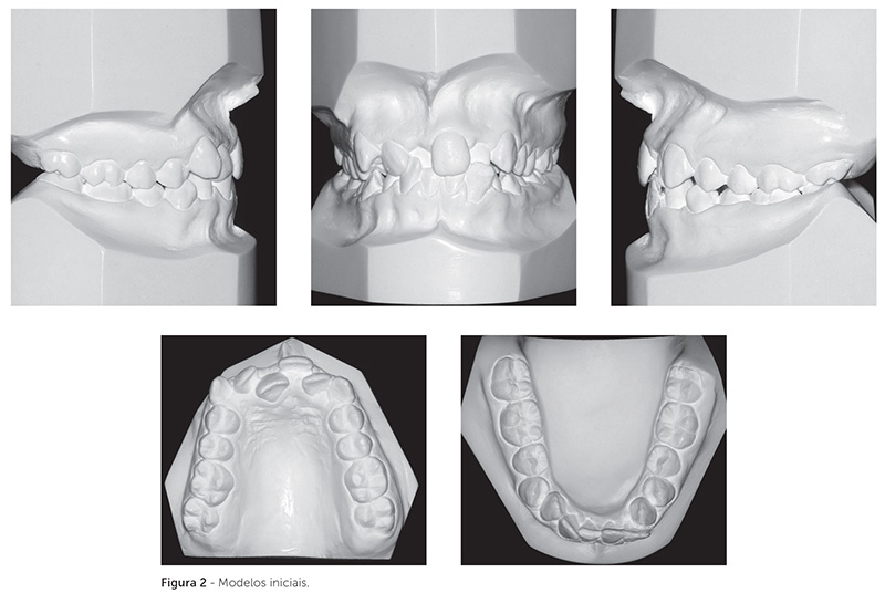 dpjo_v19_n02_115fig02