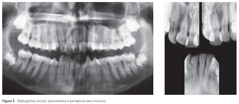 dpjo_v19_n02_115fig03