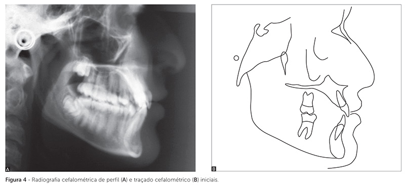 dpjo_v19_n02_115fig04