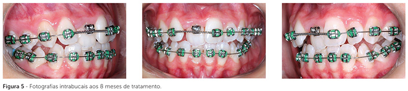 dpjo_v19_n02_115fig05