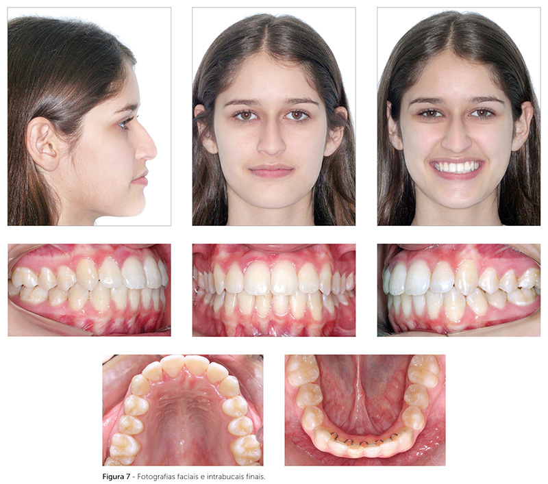 dpjo_v19_n02_115fig07