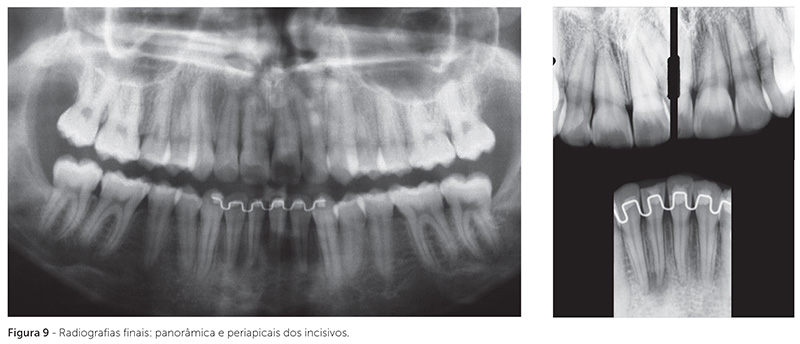 dpjo_v19_n02_115fig09