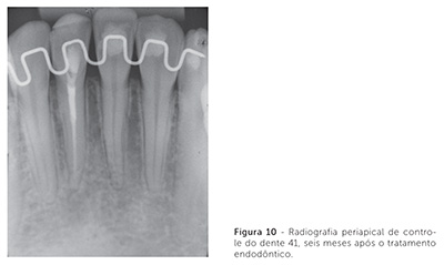 dpjo_v19_n02_115fig10