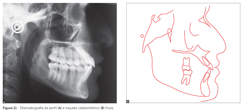 dpjo_v19_n02_115fig11