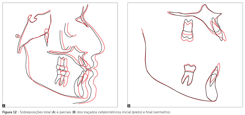 dpjo_v19_n02_115fig12