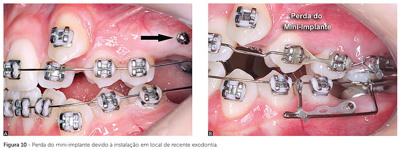 dpjo_v19_n02_18fig10