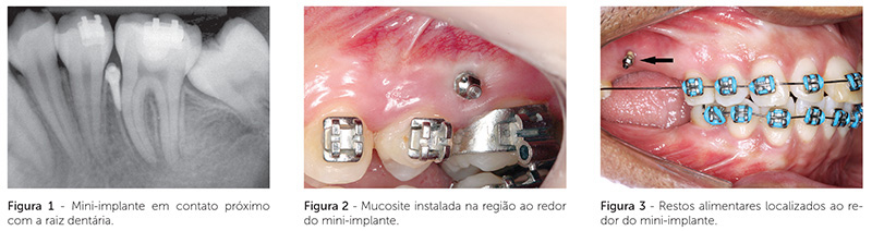 dpjo_v19_n02_18fig_01_2_3