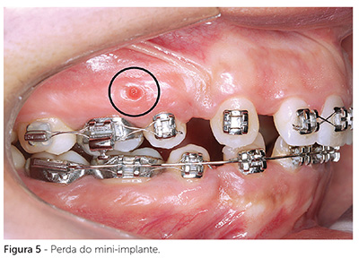 dpjo_v19_n02_18fig_05