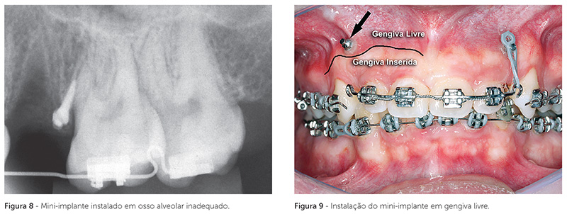 dpjo_v19_n02_18fig_08_9