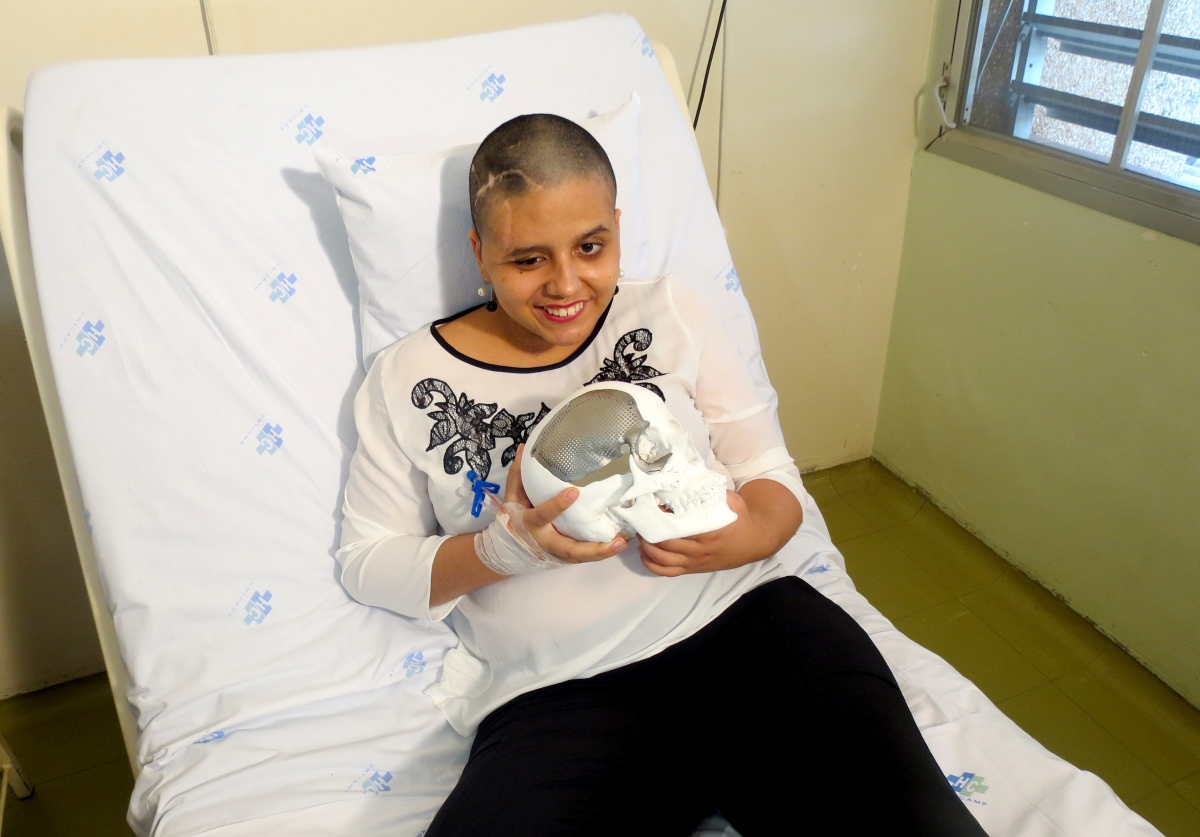 Jéssica Cussioli foi a primeira pessoa no país a receber, simultaneamente, três placas de titânio para reconstrução crânio-facial, no HC da Unicamp (Foto: Divulgação)